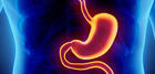 How Long Does It Take to See Results After Gastric Plication?