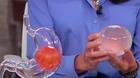 Is a Gastric Balloon the Right Choice for You in Dubai?